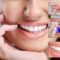 cosmetic dentistry