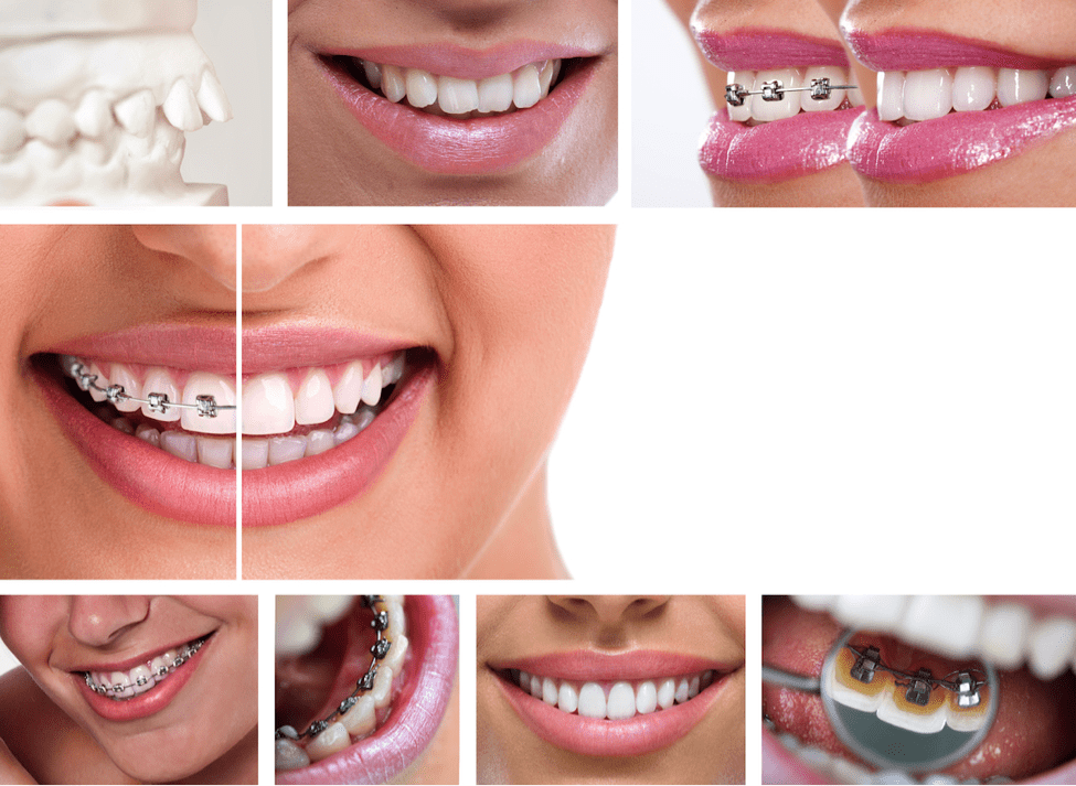 cosmetic dentistry in NL